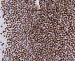 H4K5ac Antibody in Immunohistochemistry (Paraffin) (IHC (P))