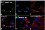 IGF2R Antibody in Immunocytochemistry (ICC/IF)