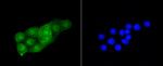 CDK2 Antibody in Immunocytochemistry (ICC/IF)