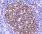 CDK2 Antibody in Immunohistochemistry (Paraffin) (IHC (P))