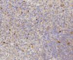 CDK2 Antibody in Immunohistochemistry (Paraffin) (IHC (P))