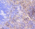 CDK2 Antibody in Immunohistochemistry (Paraffin) (IHC (P))