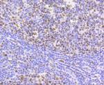 HP1 alpha Antibody in Immunohistochemistry (Paraffin) (IHC (P))