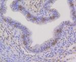 HP1 alpha Antibody in Immunohistochemistry (Paraffin) (IHC (P))