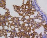 ARPC5 Antibody in Immunohistochemistry (Paraffin) (IHC (P))