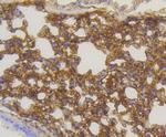 Caveolin 1 Antibody in Immunohistochemistry (Paraffin) (IHC (P))