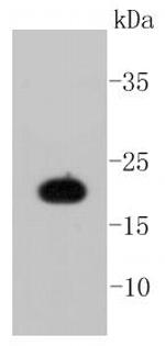 Caveolin 1 Antibody in Western Blot (WB)