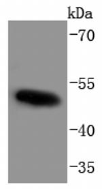 Phospho-c-Myc (Thr58, Ser62) Antibody in Western Blot (WB)