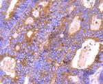 BCL-XL Antibody in Immunohistochemistry (Paraffin) (IHC (P))