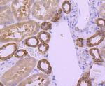 BCL-XL Antibody in Immunohistochemistry (Paraffin) (IHC (P))