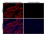 BCL-XL Antibody in Immunohistochemistry (Paraffin) (IHC (P))