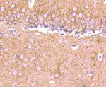 Beta III Tubulin Antibody in Immunohistochemistry (Paraffin) (IHC (P))