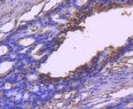 VEGF Antibody in Immunohistochemistry (Paraffin) (IHC (P))