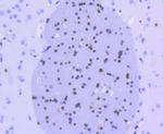 OLIG2 Antibody in Immunohistochemistry (Paraffin) (IHC (P))