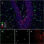 OLIG2 Antibody in Immunohistochemistry (Frozen) (IHC (F))