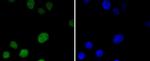 MSH6 Antibody in Immunocytochemistry (ICC/IF)