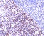 MSH6 Antibody in Immunohistochemistry (Paraffin) (IHC (P))