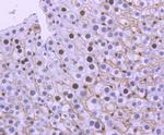 MSH6 Antibody in Immunohistochemistry (Paraffin) (IHC (P))