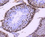 MSH6 Antibody in Immunohistochemistry (Paraffin) (IHC (P))