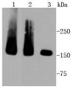 MSH6 Antibody in Western Blot (WB)