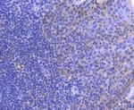 MLH1 Antibody in Immunohistochemistry (Paraffin) (IHC (P))