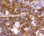 PHD1 Antibody in Immunohistochemistry (Paraffin) (IHC (P))