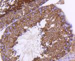 PHD1 Antibody in Immunohistochemistry (Paraffin) (IHC (P))