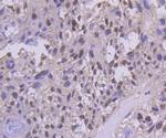 PMS2 Antibody in Immunohistochemistry (Paraffin) (IHC (P))