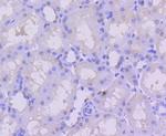 PMS2 Antibody in Immunohistochemistry (Paraffin) (IHC (P))