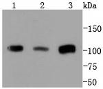 PMS2 Antibody in Western Blot (WB)