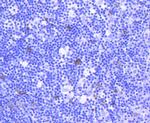 TACC3 Antibody in Immunohistochemistry (Paraffin) (IHC (P))