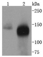 TACC3 Antibody in Western Blot (WB)