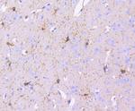 CD140b (PDGFRB) Antibody in Immunohistochemistry (Paraffin) (IHC (P))