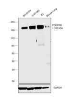 CD140b (PDGFRB) Antibody in Western Blot (WB)