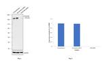 CD140b (PDGFRB) Antibody in Western Blot (WB)