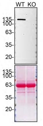 SHIP1 Antibody in Western Blot (WB)