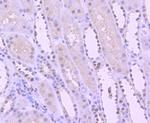 YY1 Antibody in Immunohistochemistry (Paraffin) (IHC (P))