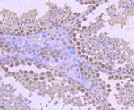 YY1 Antibody in Immunohistochemistry (Paraffin) (IHC (P))