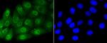 Phospho-Smad5 (Ser463,Ser465) Antibody in Immunocytochemistry (ICC/IF)