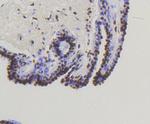 Phospho-Smad5 (Ser463,Ser465) Antibody in Immunohistochemistry (Paraffin) (IHC (P))