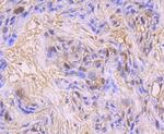 CDK1 Antibody in Immunohistochemistry (Paraffin) (IHC (P))