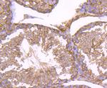 HSP90 beta Antibody in Immunohistochemistry (Paraffin) (IHC (P))