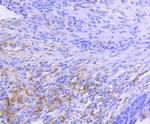 HSP90 alpha Antibody in Immunohistochemistry (Paraffin) (IHC (P))