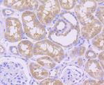 MCL-1 Antibody in Immunohistochemistry (Paraffin) (IHC (P))