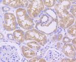 MCL-1 Antibody in Immunohistochemistry (Paraffin) (IHC (P))