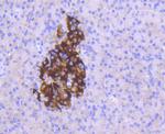 MCL-1 Antibody in Immunohistochemistry (Paraffin) (IHC (P))