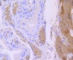 Calponin 1 Antibody in Immunohistochemistry (Paraffin) (IHC (P))