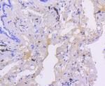 SMAD5 Antibody in Immunohistochemistry (Paraffin) (IHC (P))