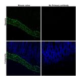 Desmin Antibody in Immunohistochemistry (Paraffin) (IHC (P))