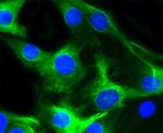 Desmin Antibody in Immunocytochemistry (ICC/IF)